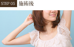 施術後