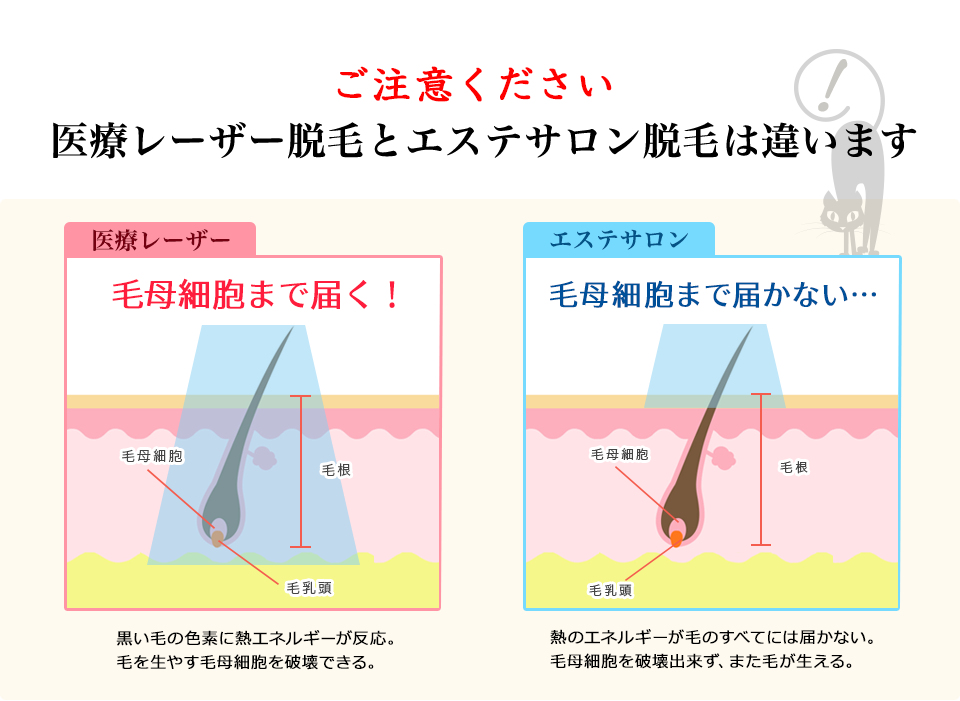 エステ脱毛との違い