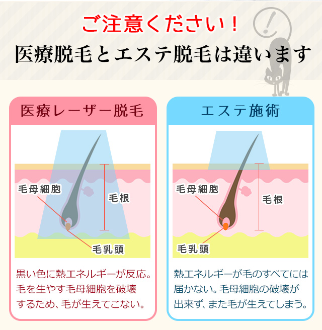 エステ脱毛との違い