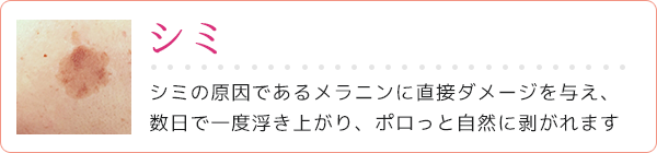 シミ