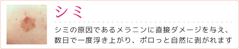 シミ