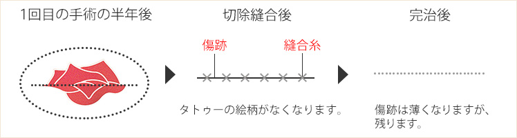 絵柄のサイズが大きい場合の2回目